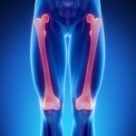 Pain Management 2 Pain Management 2